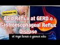 ANO ANG ACID REFLUX ?ANO ANG GERD? SINTOMAS ng acid reflux o GERD. Mga Gamot sa acid reflux o GERD