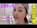 【美容医療】効いたもの・効かなかったもの正直レビュー✨ピコレーザー|ハイドラフェイシャル|エレクトロポレーション
