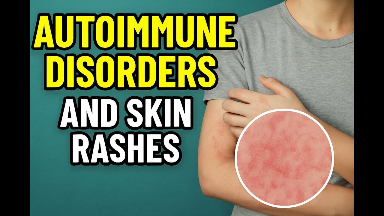 Why Your Skin Health Could Be Making You Sick? Skin Rashes and ...