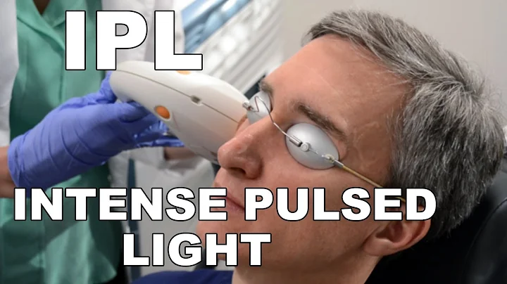 IPL (Intense Pulsed Light) - Dr. Paul Ruff and Christy McHale, CANS | West End Plastic Surgery