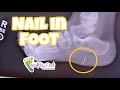 DOCTOR PULLS RUSTY NAIL OUT OF FOOT!