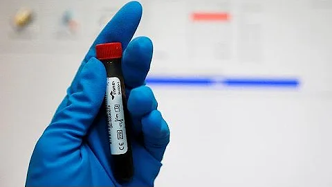 Quali sono le nazioni che hanno utilizzato il doping di Stato?
