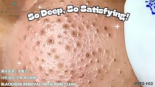 Insanely Satisfying Nose Blackhead Plucking Close-Up | Plucking with Tweezers | 鼻角栓 ピンセット 피지제거