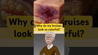 The Science Behind The Colorful Healing Of A Bruise