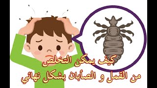 كيف يمكن التخلص من القمل و الصيبان بشكل نهائي و افضل طريقة