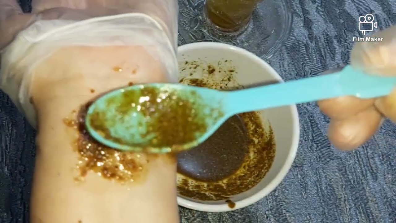 القسط الهندي أقوى ماسك مبيض رائع جدا للكلف والتصبغات ونمش وأثار حب شباب وتجاعيد ومرمم للبشرة 🌿👍🌿