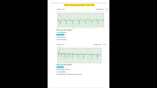 Relias Dysrhythmia Basic A Test 2025 WITH COMPLETE SOLUTIONS GRADED A+ PROVIDES FULL EXPLANATIONS