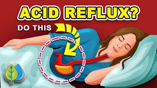 3 Ways to Stop ACID REFLUX Naturally | How to Stop Acid Reflux & HEARTBURN