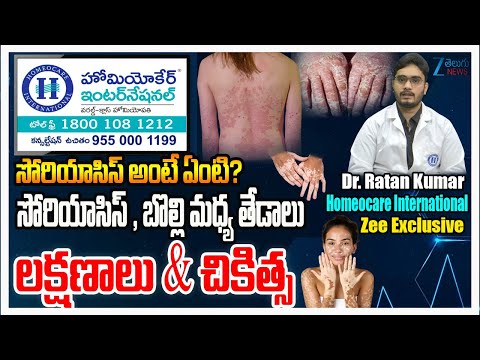 Skin Problems: Psoriasis and Vitiligo Symptoms | Dr.Rathan kumar | Homeocare International | ZEENews
