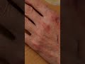 Сок алоэ легко и полностью переходит с ватного диска на кожу практически без остатка 1