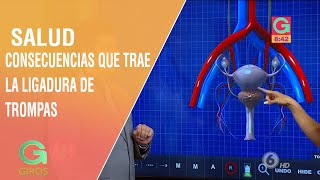 La venosa de complicaciones ligadura