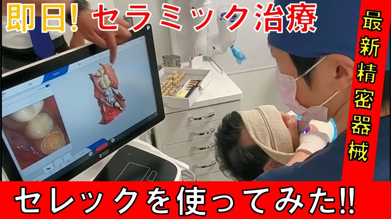その日にセラミックが入る「セレック」を実際に使ってみた！CEREC One day Dentistry