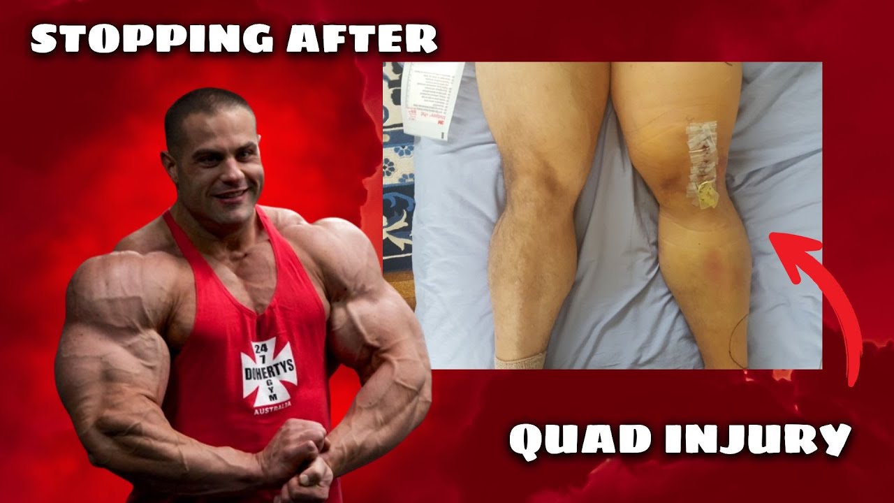 The Bodybuilding TRAP: When Injuries Force You to Quit The Stage