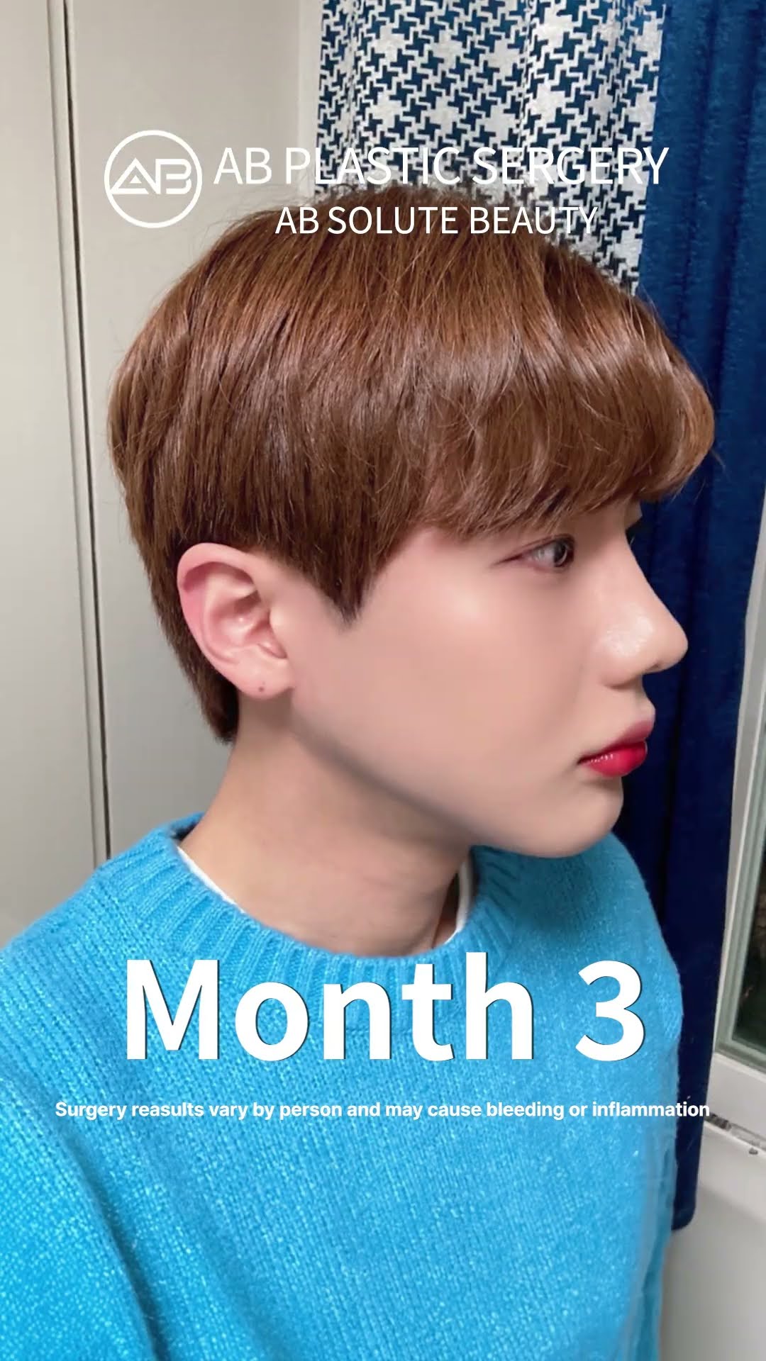 Jawline Surgery & Contouring Korean Man’s Stunning Before & After #shorts