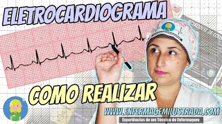 ELETROCARDIOGRAMA: Como é Realizado