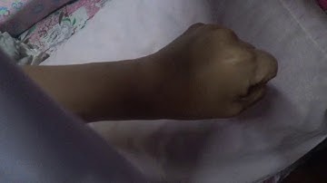 Closed Fist (Horizontal Hand) Bandaging for Triangular Bandagr