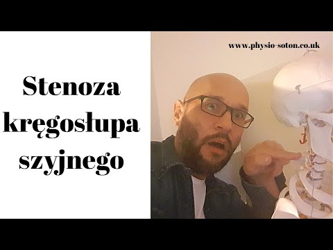 Problemy z chodzeniem, brakiem siły i czucia a stenoza kręgosłupa.