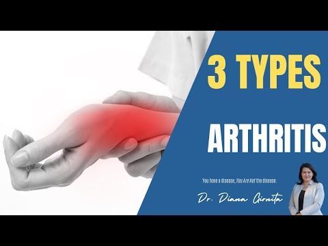 What are the most common types of Arthritis?