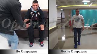 Akgun ATES / До и После Операции