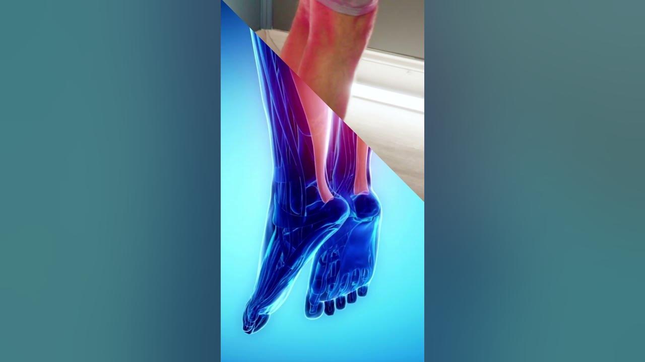 strengthen-your-achilles-tendon-with-this-exercise-youtube