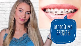 картинка: БРЕКЕТЫ ВТОРОЙ РАЗ 😬 СКОЛЬКО, КАК, ЗАЧЕМ? Ошибки после снятия брекетов