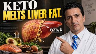 KETO CUT LIVER FAT BY 67% — BUT WHAT ABOUT CHOLESTEROL?#sugarmd