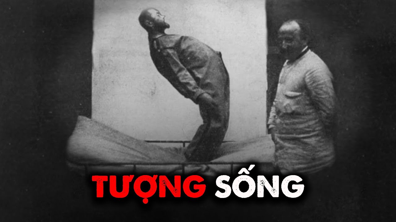 Tại sao căn bệnh này có thể biến con người thành Tượng Sống?