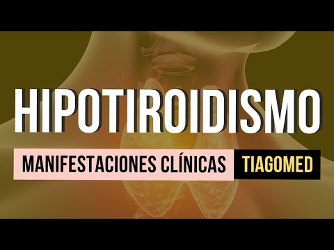 Video: ¿Cuál de las siguientes es una manifestación clínica del hipoparatiroidismo?