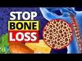 ✨Top 9 Vitamin K2 Foods to Stop Bone Loss & Reduce Artery Stiffness