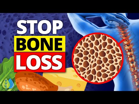 Video: 4 Makanan Penting Untuk Aterosklerosis