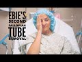 Ebie's Second Fallopian Tube Removal (Salpingectomy)