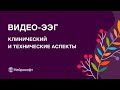 Видео-ЭЭГ: клинический и технические аспекты