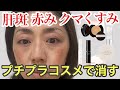 【肝斑・クマ・赤み・くすみ】プチプラコスメで厳選して消せるアイテムをご紹介します♡40代50代必見！