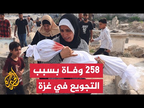 وزارة الصحة بغزة: وفاة 7 أشخاص بسبب سوء التغذية خلال 24 ساعة