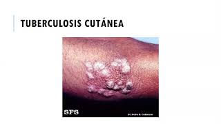 ENFERMEDADES INFECCIOSAS EN DERMATOLOGIA VIDEOCLASE ZOOM