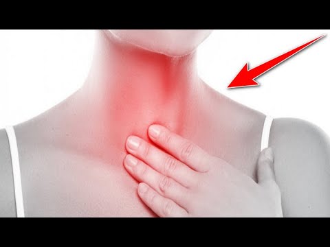 Βίντεο: Πώς να καθαρίσετε τον φλεγματικό λαιμό;