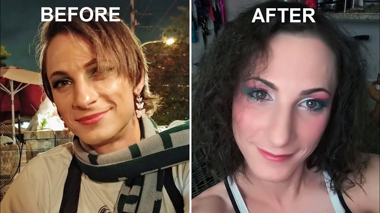 Physical And Mental Effects Of Hrt Transgender Mtf 3 5 Months On Hormones Youtube