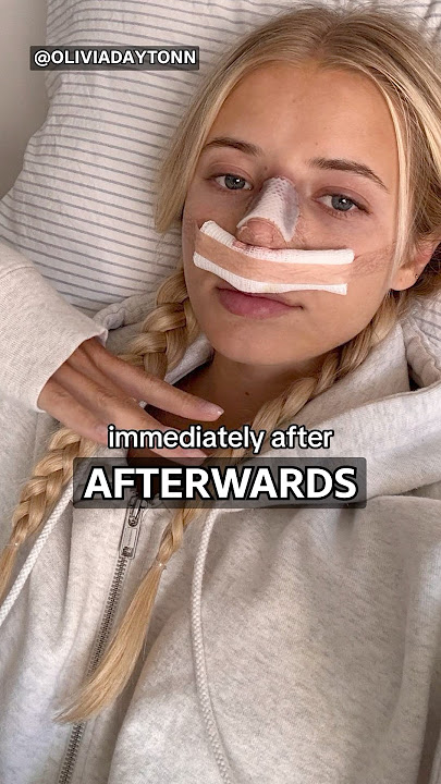 Surgeon Reacts to Nose Job Recovery