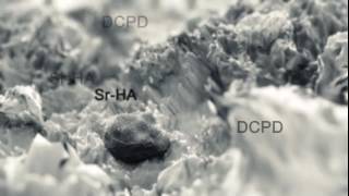 Calcium Phosphate bone cement containing Strontium