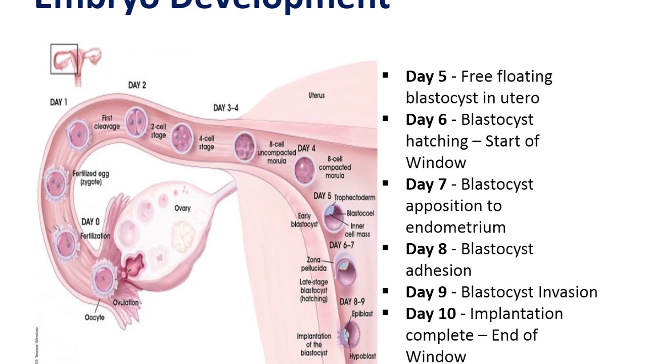 Blastocyst stage versus Cleavage stage transfer