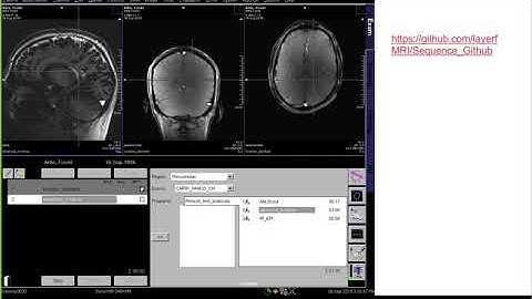 Renzo Huber: Virtual Hands on scanning of high resolution fMRI data