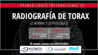 PRIMER CURSO INTERNACIONAL DE TÓRAX: LO NORMAL Y LO PATOLÓGICO- #8 Tromboembolismo Pulmonar PRIMER CURSO INTERNACIONAL DE TÓRAX: LO NORMAL Y LO PATOLÓGICO- #8 Tromboembolismo Pulmonar