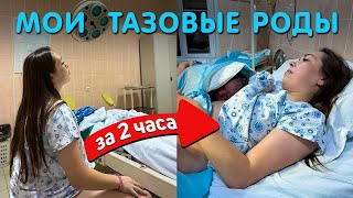 Роды за 2 часа 😳 Моя история родов в тазовом предлежании 🤰