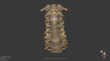3D Video Rendering of the Cervical Spine Hardware - Amazing Settlements