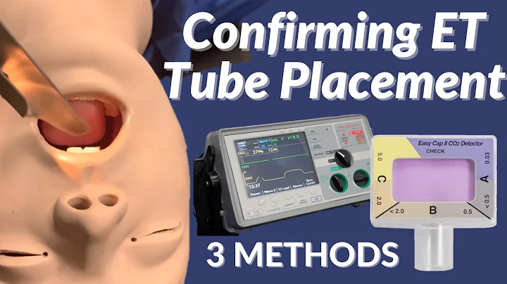 How to Confirm ET Tube Placement (3 Methods)