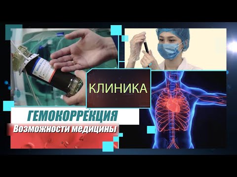Очищение крови человека. К чему это приводит? «Клиника» | Jibek Joly TV