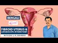 Fibroid Uterus &amp; Laparoscopic Myomectomy | Dr. SM Rahman | Cradle Fertility Center