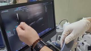 Used Alpinion E cube 9 with Convex and Linear Ultrasound
