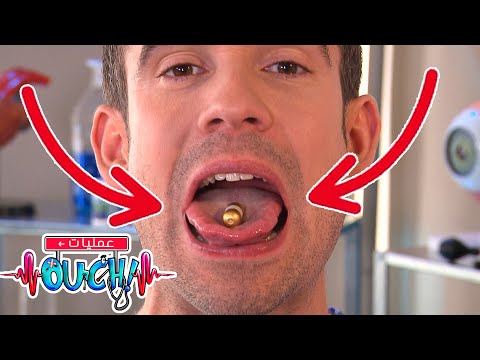 الدكتور كريس يبتلع كاميرا أوبريشن آوتش