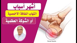 اكثر اسباب الشوكه العظميه والتهاب  اللفافة الاخمصيه زياده الوزن والأحذية اللينه | دكتور طارق تركى screenshot 3